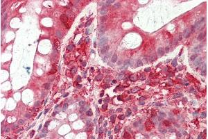 ABIN768660 (5µg/ml) staining of paraffin embedded Human Colon. (TFB2M antibody  (Internal Region))