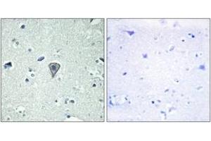 Immunohistochemistry analysis of paraffin-embedded human brain tissue, using ETBR2 Antibody. (ETBR2 antibody  (AA 1-50))