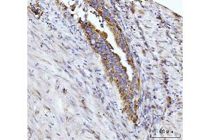 IHC analysis of Glutaminase/GLS using anti-Glutaminase/GLS antibody (ABIN7601602). (Glutaminase antibody  (AA 396-654))