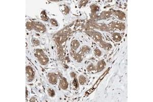 Immunohistochemical staining of human breast with OTUD6B polyclonal antibody  shows distinct cytoplasmic positivity in glandular cells at 1:50-1:200 dilution. (OTUD6B antibody)