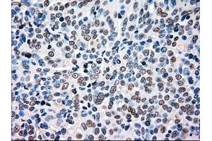 Immunohistochemistry (IHC) image for anti-B-Raf proto-oncogene, serine/threonine kinase (BRAF) antibody (ABIN1496954) (BRAF antibody)