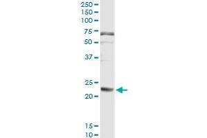 Immunoprecipitation of FGA transfected lysate using anti-FGA monoclonal antibody and Protein A Magnetic Bead , and immunoblotted with FGA MaxPab rabbit polyclonal antibody. (FGA antibody  (AA 1-218))