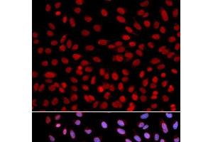 Immunofluorescence analysis of U2OS cells using DNA polymerase eta Polyclonal Antibody (POLH antibody)