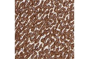 Immunohistochemical staining of human liver with ECH1 polyclonal antibody  shows strong cytoplasmic positivity in hepatocytes.