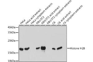 Western blot analysis of extracts of various cell lines, using Histone H2B antibody (ABIN7267736) at 1:1000 dilution. (HIST1H2BK antibody)