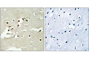 Immunohistochemistry analysis of paraffin-embedded human brain tissue, using NCOA5 Antibody. (NCOA5 antibody  (AA 345-394))