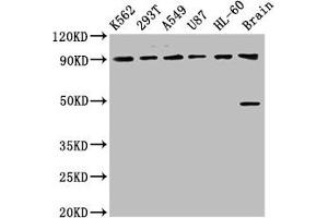 Western Blot Positive WB detected in: K562 whole cell lysate, 293T whole cell lysate, A549 whole cell lysate, U87 whole cell lysate, HL60 whole cell lysate, Rat brain tissue All lanes: OCA2 antibody at 8. (OCA2 antibody  (AA 2-136))