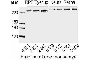 Immunoblot for ABCA4 protein using neural retina and RPE/eyecup homogenates loaded as a fraction of one mouse eye per lane, as indicated. (ABCA4 antibody  (AA 2250-2263))