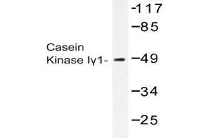 Western blot (WB) analysis of Casein Kinase Igamma1 antibody in extracts from COS-7 cells. (CSNK1G1 antibody)