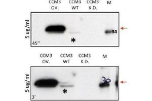 Western Blot using Anti Human CCCM3 antibody Cat. (PDCD10 antibody  (N-Term))