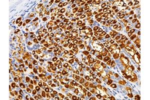 ABIN6259968 and ABIN6266497 at 1/100 staining Rat stomach tissue by IHC-P. (APAF1 antibody  (C-Term))