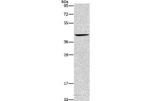 Western blot analysis of Mouse liver tissue, using ORM2 Polyclonal Antibody at dilution of 1:500