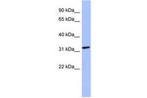 Image no. 1 for anti-Melanoma Antigen Family B, 2 (MAGEB2) (N-Term) antibody (ABIN6744050) (MAGEB2 antibody  (N-Term))