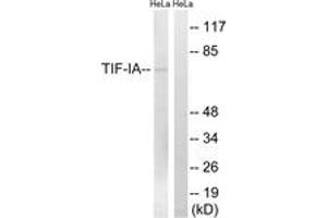 Western blot analysis of extracts from HeLa cells, treated with calyculinA 50ng/ml 30', using TIF-IA (Ab-649) Antibody. (RRN3 antibody  (AA 602-651))