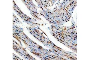 IHC analysis of CD31/Pecam1 using anti-CD31/Pecam1 antibody (ABIN7601662).