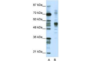 WB Suggested Anti-CORO1A Antibody Titration:  1.