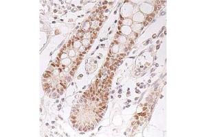 Immunohistochemistry (IHC) image for anti-Checkpoint Kinase 2 (CHEK2) antibody (ABIN487488) (CHEK2 antibody)