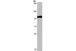 Western Blotting (WB) image for anti-Plasminogen (PLG) antibody (ABIN2435219) (PLG antibody)