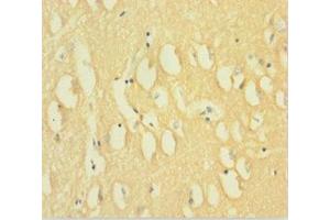 Immunohistochemistry of paraffin-embedded human brain tissue using ABIN7150825 at dilution of 1:100 (Dynamin 1 antibody  (AA 2-245))