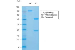 SDS-PAGE Analysis of Purified Thyroglobulin Rabbit Recombinant Monoclonal Antibody (TGB/1970R). (Recombinant Thyroglobulin antibody)