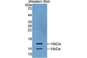 Western Blotting (WB) image for anti-Chemokine (C-C Motif) Ligand 24 (CCL24) antibody (FITC) (ABIN1862929) (CCL24 antibody  (FITC))