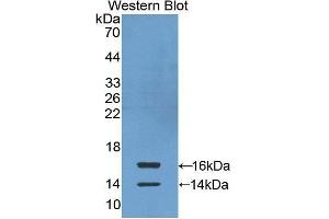 Western Blotting (WB) image for anti-Chemokine (C-C Motif) Ligand 24 (CCL24) antibody (FITC) (ABIN1862929)