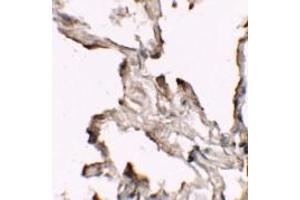 Immunohistochemistry of NIBRIN in human lung tissue with NIBRIN antibody (C-term) Cat. (Nibrin antibody  (C-Term))