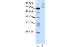 WB Suggested Anti-ZNF709 Antibody Titration:  2. (ZNF709 antibody  (N-Term))