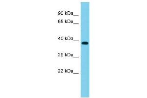 Host: Rabbit Target Name: SDCCAG3 Sample Type: Fetal Heart lysates Antibody Dilution: 1.