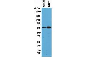 Western blot of human Jurkat and IMR32 cell lysate using recombinant SMAD4 antibody at 1:500. (Recombinant SMAD4 antibody  (C-Term))