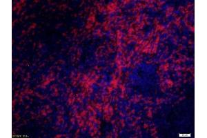Paraformaldehyde-fixed, paraffin embedded rat spleen, Antigen retrieval by boiling in sodium citrate buffer (pH6) for 15min, Block endogenous peroxidase by 3% hydrogen peroxide for 30 minutes, Blocking buffer (normal goat serum) at 37°C for 20min, Antibody incubation with CD8 alpha Polyclonal Antibody, Unconjugated  at 1:200 overnight at 4°C, followed by a conjugated secondary Goat Anti-Rabbit IgG, Cy3 conjugated-Cy3)used at 1:200 dilution for 40 minutes at 37°C and DAPI staining. (CD8 alpha antibody  (AA 51-150))