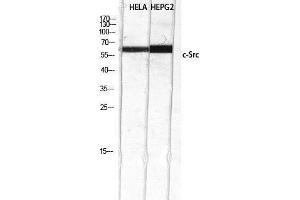 Western Blotting (WB) image for anti-Proto-oncogene tyrosine-protein kinase Src (Src) (Tyr1172) antibody (ABIN3184114) (Src antibody  (Tyr1172))