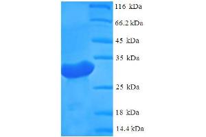 SDS-PAGE (SDS) image for Polymerase (DNA Directed), gamma (POLG) (AA 192-325), (partial) protein (His-SUMO Tag) (ABIN4975313) (POLG Protein (AA 192-325, partial) (His-SUMO Tag))
