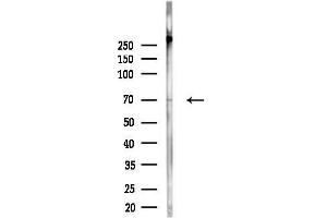 anti-Mitogen-Activated Protein Kinase Kinase Kinase 2 (MAP3K2) (C-Term) antibody