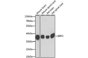 Western blot analysis of extracts of various cell lines, using SIRT2 antibody. (SIRT2 antibody)