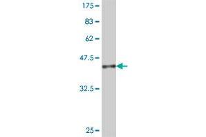 Western Blot detection against Immunogen (37. (CHST4 antibody  (AA 221-320))
