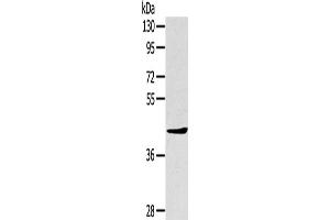 Western Blotting (WB) image for anti-TNFAIP3 Interacting Protein 2 (TNIP2) antibody (ABIN2427434) (TNIP2 antibody)