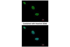 ICC/IF Image Immunofluorescence analysis of paraformaldehyde-fixed HeLa, using TLE2, antibody at 1:500 dilution. (TLE2 antibody  (C-Term))