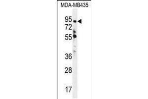 Western blot analysis in MDA-MB435 cell line lysates (35ug/lane). (ZNF605 antibody  (N-Term))