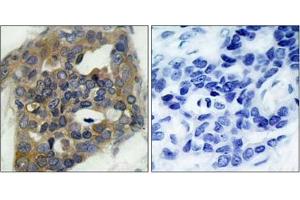Image no. 1 for anti-Mitogen-Activated Protein Kinase Kinase Kinase 5 (MAP3K5) (pSer966) antibody (ABIN196915) (ASK1 antibody  (pSer966))