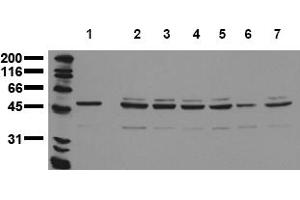 Western Blotting (WB) image for anti-Aurora Kinase A (AURKA) (N-Term) antibody (ABIN492608) (Aurora A antibody  (N-Term))