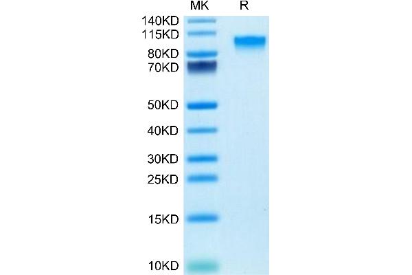 IL17RA Protein (AA 32-322) (Fc Tag)