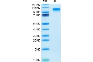 IL17RA Protein (AA 32-322) (Fc Tag)