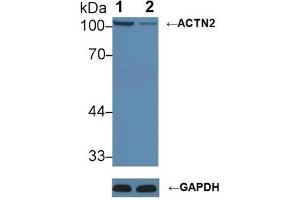 Knockout Varification:,Lane 1: Wild-type Hela cell lysate,Lane 2: ACTN2 knockout Hela cell lysate,Predicted MW: 104 kDa ,Observed MW: 104 kDa,Primary Ab: 1 μg/mL Rabbit Anti-Mouse ACTN2 Antibody,Second Ab: 0.