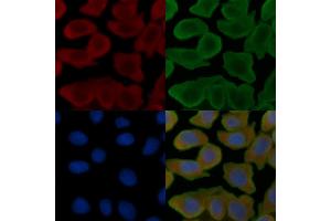 ABIN6261425 and ABIN6266808 staining Hela cells(30 min of UV treatment) by IF/ICC.