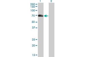 Western Blotting (WB) image for anti-A Kinase (PRKA) Anchor Protein 10 (AKAP10) (AA 1-101) antibody (ABIN599175) (AKAP10 antibody  (AA 1-101))