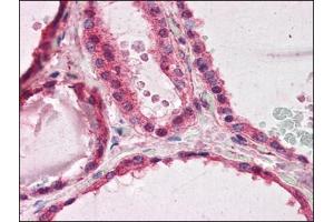 Human Thyroid (formalin-fixed, paraffin-embedded) stained with PAFAH1B1at 3. (PAFAH1B1 antibody  (C-Term))