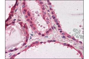 Human Thyroid (formalin-fixed, paraffin-embedded) stained with PAFAH1B1at 3.