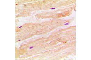 Immunohistochemical analysis of RRAD staining in human muscle formalin fixed paraffin embedded tissue section.