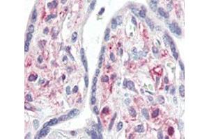 IHC analysis of FFPE human placenta tissue stained with IRAK antibody (IRAK1 antibody  (AA 683-712))
